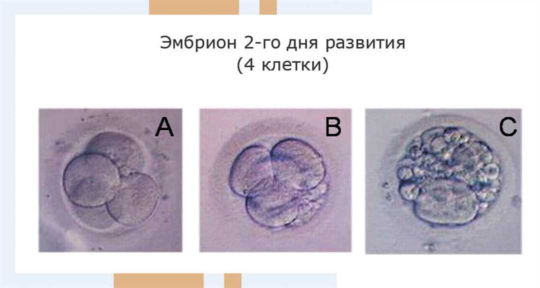 Современные подходы к самосовершенствованию с удалением в условиях сахарного поста